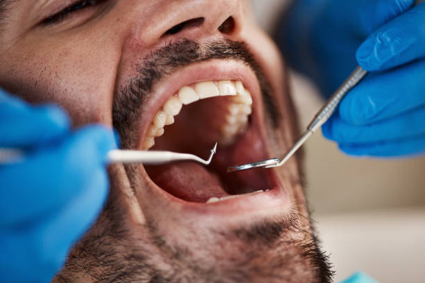 Oral Cancer Screening in Enumclaw, WA